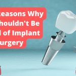 Read more about the article The Top 5 Reasons Why You Shouldn’t Be Afraid Of Implant Surgery