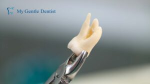 Read more about the article Affordable Dental Wisdom Tooth Extraction | How Much Does It Cost?